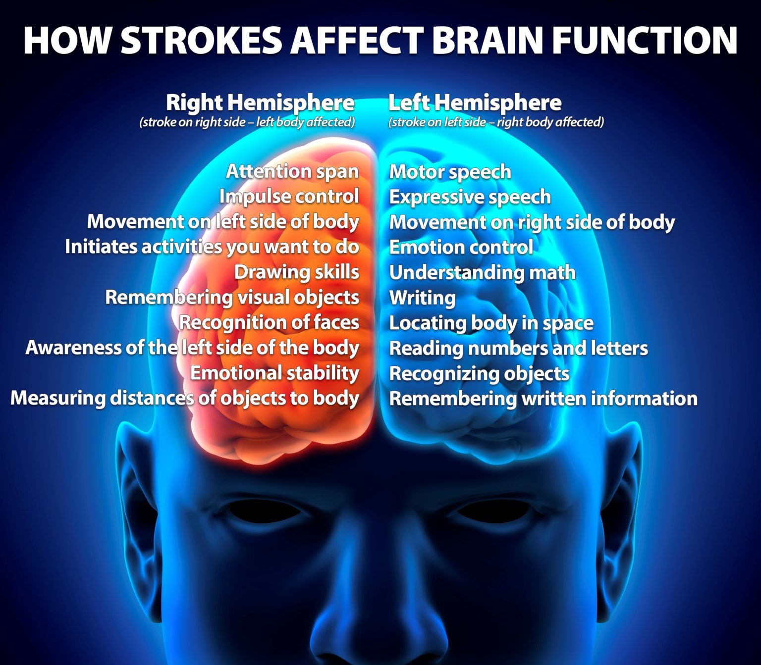 Strokes - The Brain Injury Resource Center of Wisconsin